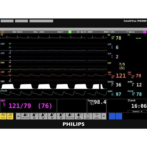 Philips IntelliVue MX800 Patient Monitor Screen Simulation for REALITi 360, 8000974, Advanced Trauma Life Support (ATLS)