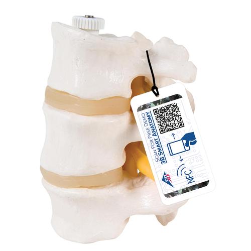 3 Human Lumbar Vertebrae, Flexibly Mounted - 3B Smart Anatomy, 1000151 [A76/8], Vertebra Models
