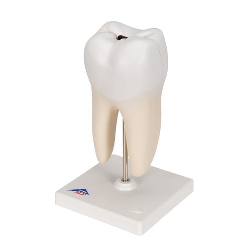 Lower Twin-Root Molar with Cavities Human Tooth Model, 2 part - 3B Smart Anatomy, 1000243 [D10/4], Replacements