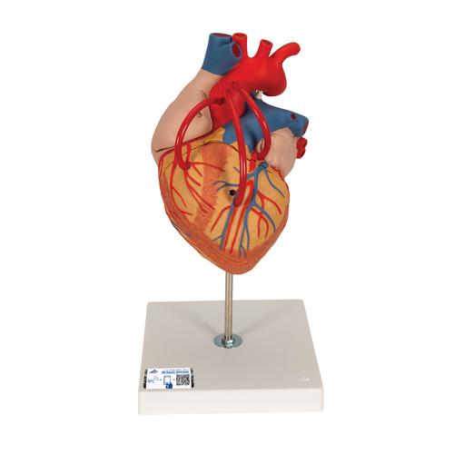 Human Heart Model with Bypass, 2 times Life-Size, 4 part - 3B Smart Anatomy, 1000263 [G06], Human Heart Models