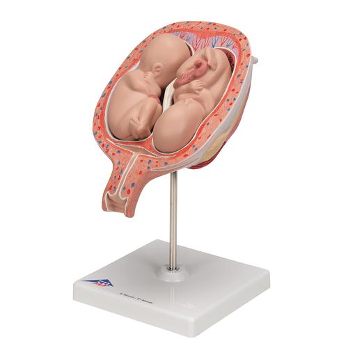 Twin Fetuses Model, 5th Month in Normal Position - 3B Smart Anatomy, 1000328 [L10/7], Pregnancy Models