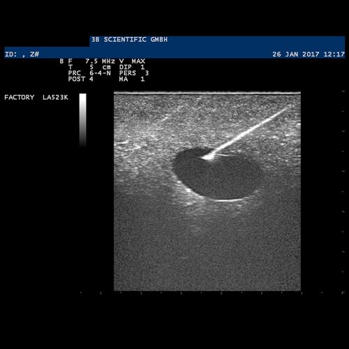 SONOtrain Breast Model with Cysts, 1019634 [P124], Ultrasound Skill Trainers