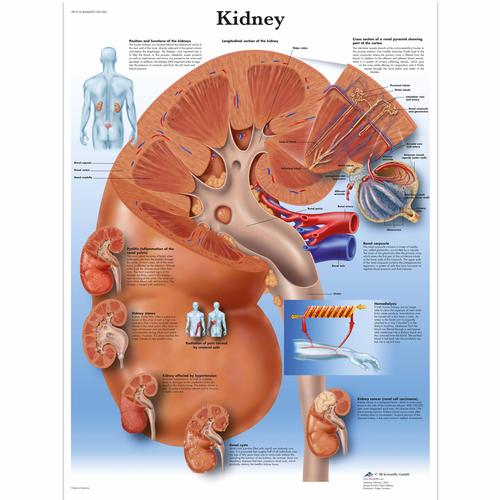 Kidney Chart, 1001564 [VR1515L], Metabolic System
