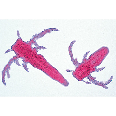 Crustacea - German Slides, 1003859 [W13004], Invertebrate (Invertebrata)