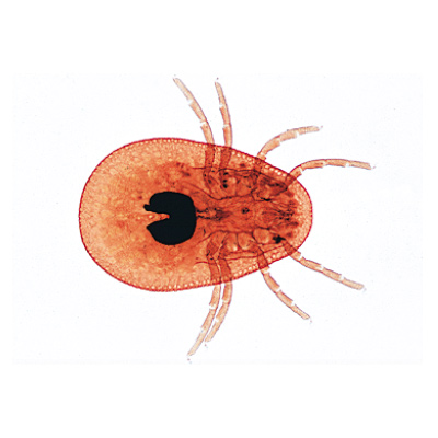 Arachnoidea and Myriapoda - German Slides, 1003863 [W13005], Microscope Slides LIEDER