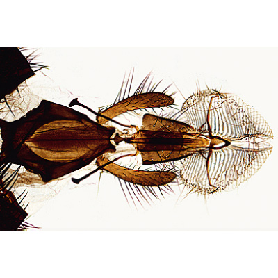 Insect (Insecta) - German Slides, 1003867 [W13006], Invertebrate (Invertebrata)
