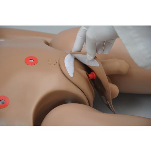 Clinical CHLOE™ Advanced Patient Care Simulator, 1017574 [W45071], Ostomy Care