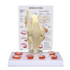 Meniscus Knee Model with 6 Tears, 1019500, Joint Models