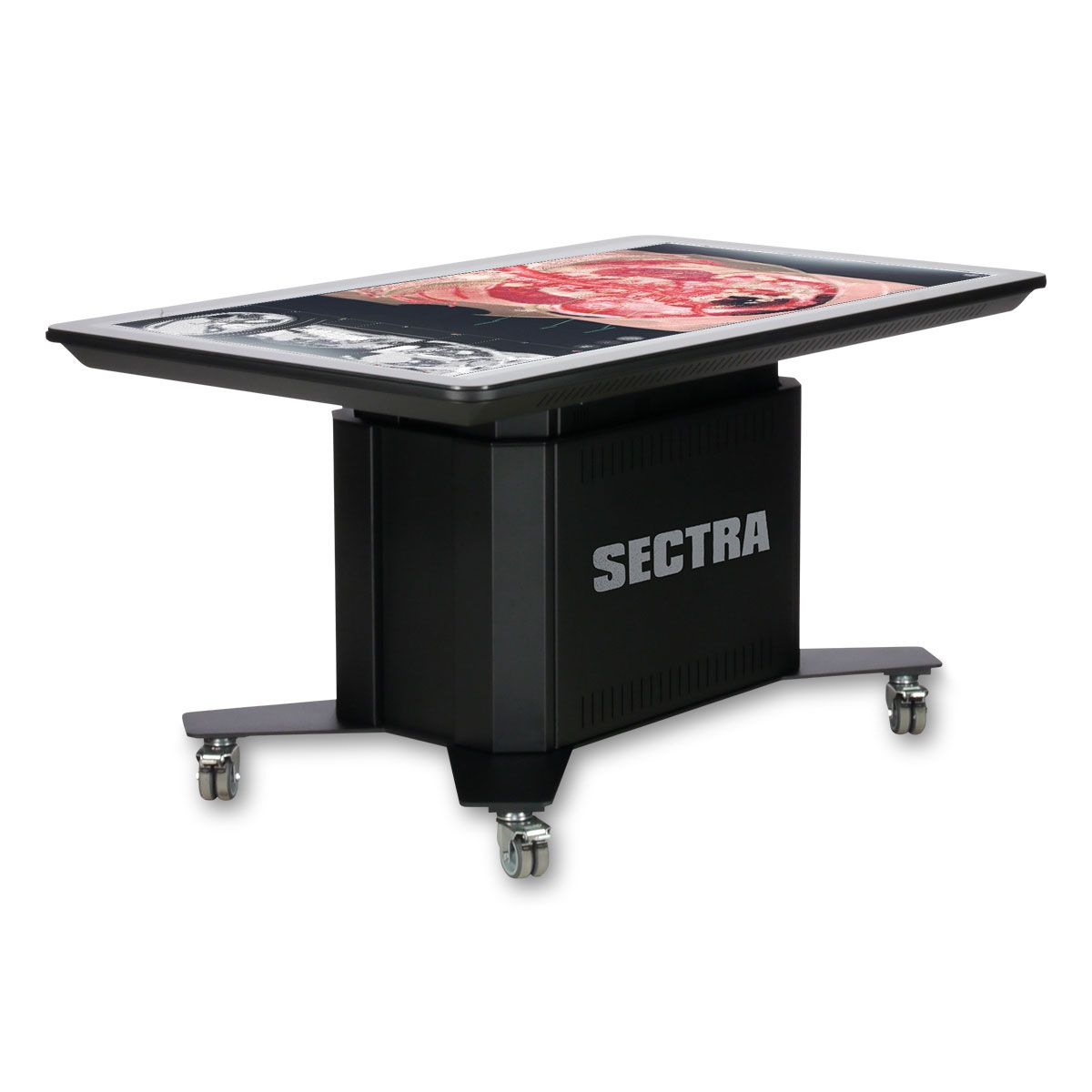 Automatic table 1. Стол Sectra. Виртуальный анатомический стол. Стол для анатомической исследования. Anatomage Table.