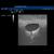 SONOtrain Breast Model with Cysts, 1019634 [P124], Ultrasound Skill Trainers (Small)