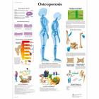 Osteoporosis Chart, 1001472 [VR1121L], Skeletal System
