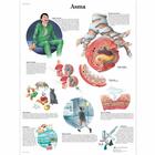 Asma, 4006924 [VR4328UU], Respiratory System