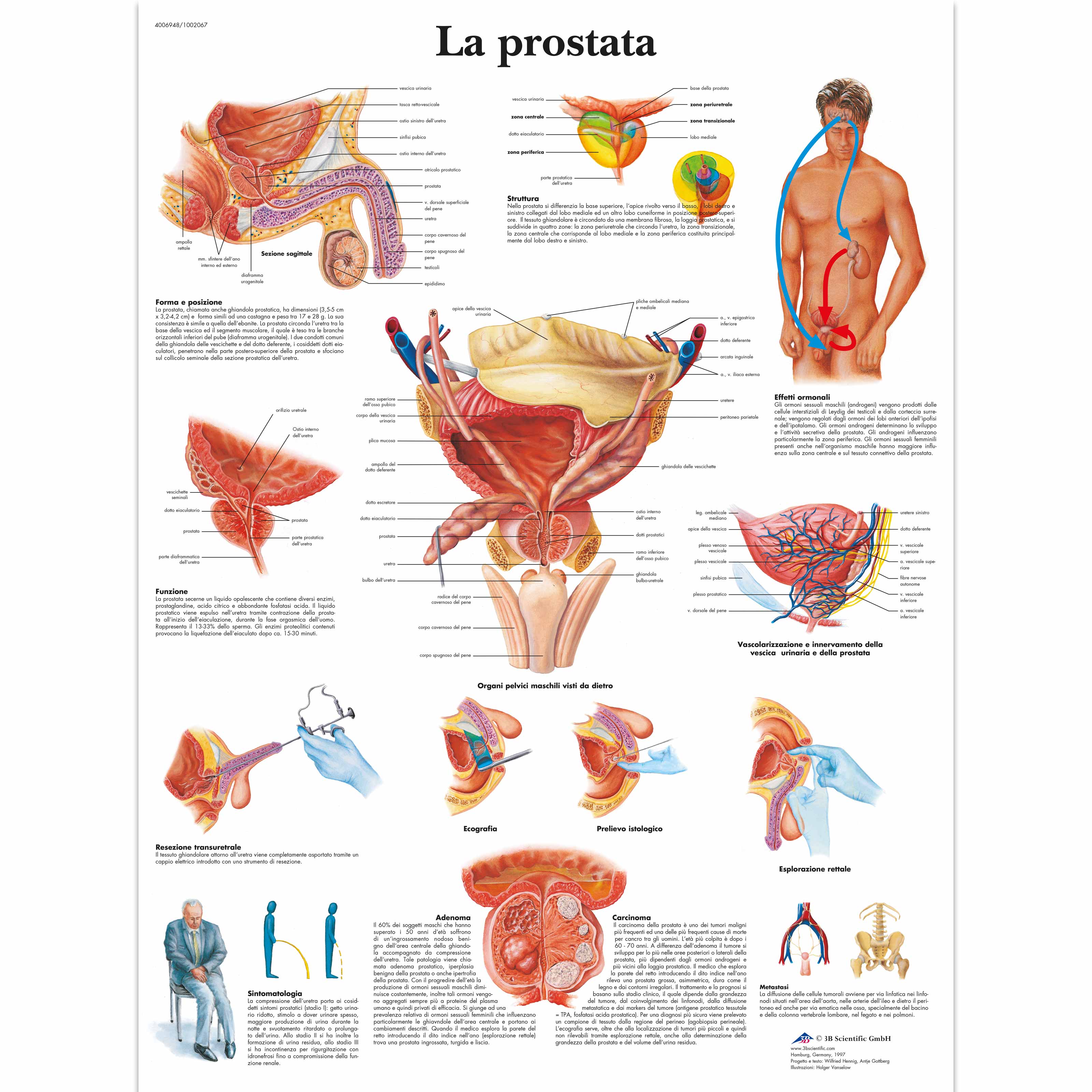 prostatita cronică 3b)