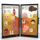 Alcohol Abuse Consequences 3-D Display, 1005582 [W43053], Drug and Alcohol Education